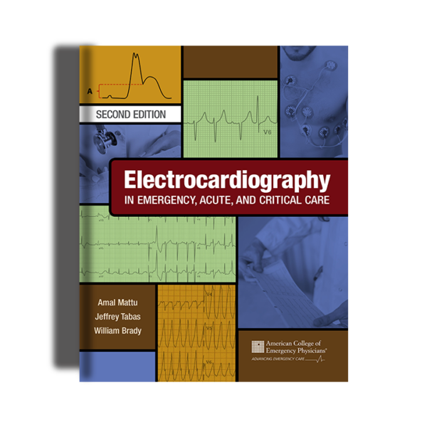 Electrocardiography in Emergency, Acute, and Critical Care, 2nd Ed.